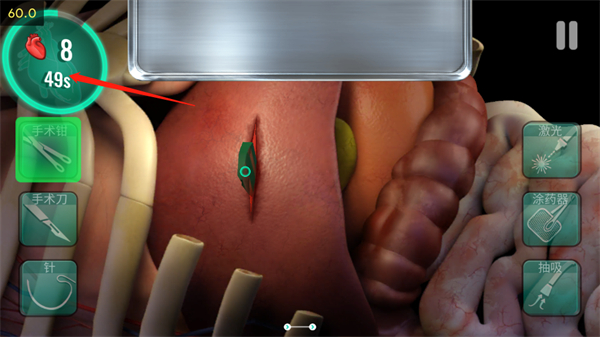 医院手术时间游戏玩法教程